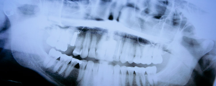 Oralchirurgie